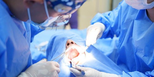 Surgical dental team operating inside a patient’s open mouth.