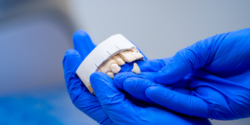 Gloved hands holding a dental model and single replacement tooth.