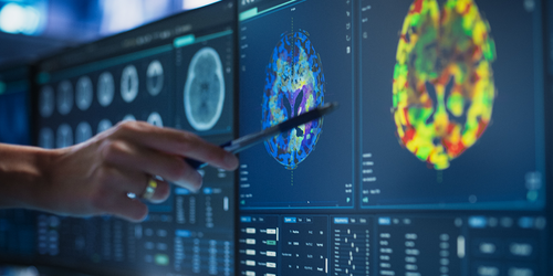 Radiologist pointing to colorful brain imaging on multiple monitors.
